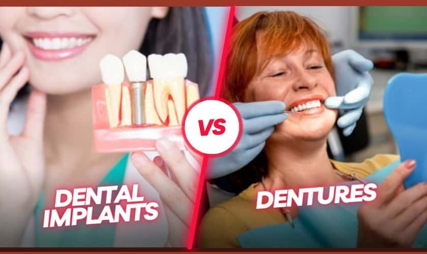 Dental Implants vs Dentures Which is Better for You?
