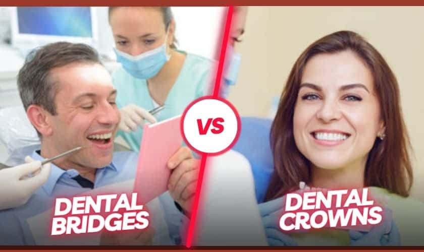 How Long Do Dental Bridges And Dental Crowns Last?