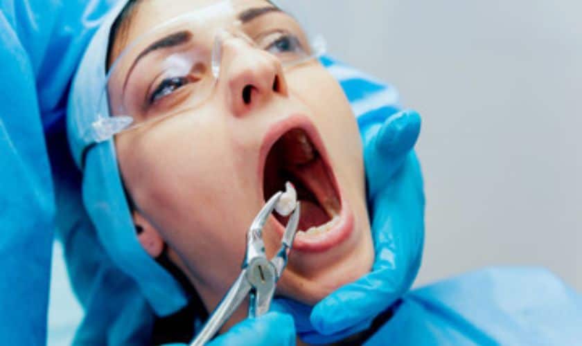 Wisdom Teeth Are Treated With Restorative Dentistry