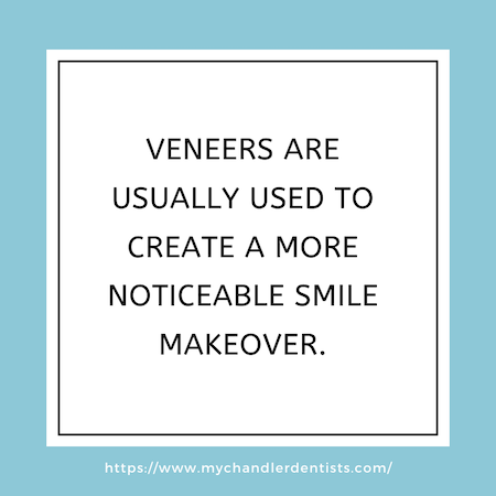 Veneers Information